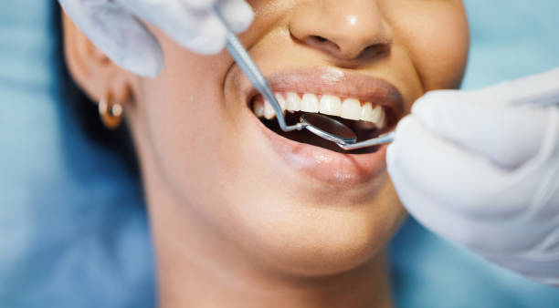 Best Emergency Root Canal Treatment in West Slope, OR